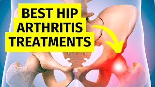 The Best Hip Arthritis Treatments Without Surgery [upl. by Aidnyl]