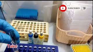 Calibration of Uric Acid Test on Microlab 300 in Urdu  Uric Acid Test Procedure  Microlab 300 [upl. by Trudie240]