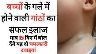 बच्चों के गले की सूजन  Neck Glands swelling  silicia 6x uses  Cal Iod 30  by DR Tarun [upl. by Stoeber]