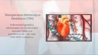 THH Telangiectasia Hemorrágica Hereditaria  Diagnóstico Genético  Secugen [upl. by Vanda]