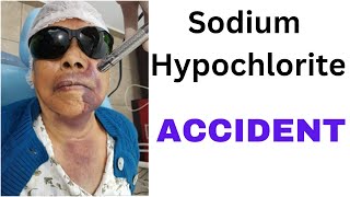 Sodium Hypochlorite Accidents in Endodontics Part 2 WHY amp management [upl. by Johns]