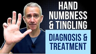 Hand Numbness amp Tingling Diagnosis amp Treatment [upl. by Yvehc]