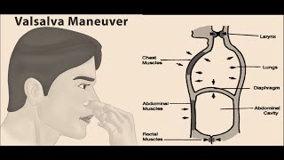 Valsalva Maneuver  Definition Uses Procedure [upl. by Aihtnic]