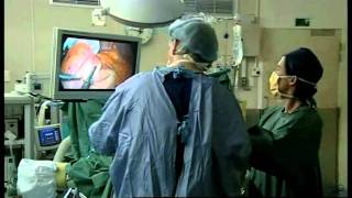 3 Live Gastric Banding Procedure Demonstration [upl. by Ruelu]