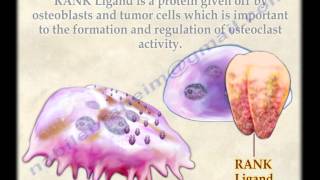 Osteoclasts  Everything You Need To Know  Dr Nabil Ebraheim [upl. by Etnuaed]