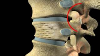 Individual vertebrae  Back and Spinal Cord [upl. by Chlores407]