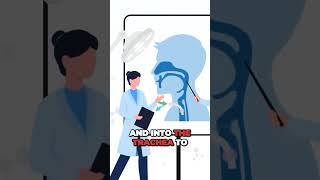 Tracheostomy Procedure Explained respiratory tracheostomy [upl. by Annunciata]