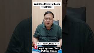 Wrinkles Removal Laser Treatment [upl. by Aiker]