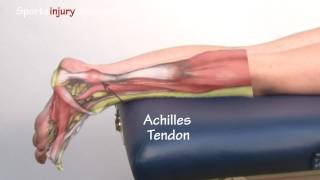 Achilles Tendonitis  Tendinopathy  Explained in 90 Seconds [upl. by Kauffmann]