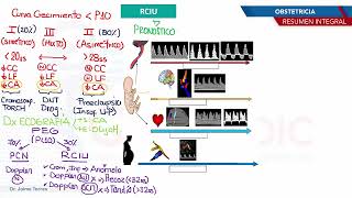 Obstetricia  RCIU [upl. by Cirred]