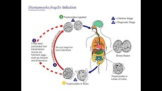 Dientamoeba fragilis ‘The unflagellated human flagellate’ [upl. by Nixie]