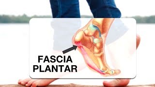 La lesión más temida por los corredores la fascitis plantar [upl. by Alard24]