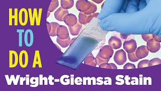 How to do a hematology stain WrightGiemsa stain Laboratory Tutorial Procedure [upl. by Sid]