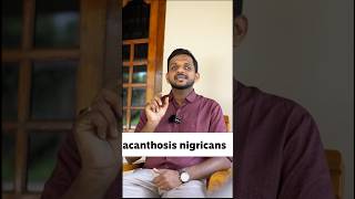 Acanthosis nigricans diabetes acanthosisnigricans insulinresistance usmle plab fmge [upl. by Yelrebma]