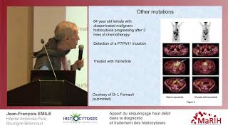 Apport du séquençage haut débit dans le diagnostic et traitement des histiocytoses [upl. by Nailliw73]