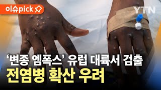 이슈픽 변종 엠폭스 치명률 높고 전파 속도 빨라…유럽 대륙서 감염자 확인  YTN [upl. by Virgilio]