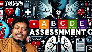 ABCDE Assessment in PRIMARY Survey emergencymedicalservices [upl. by Atig251]