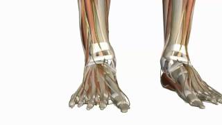 Muscles of the Foot Part 1  3D Anatomy Tutorial [upl. by Otilesoj584]