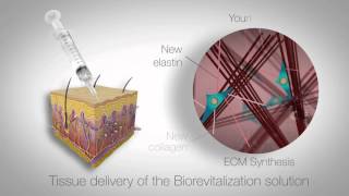 In vitro study of RRS HA injectable mesotherapy  Video abstract 95108 [upl. by Demahom225]