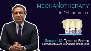 Mechanotherapy in Orthodontics Vol II Types of Forces in Orthodontics 012 [upl. by Ainegul257]