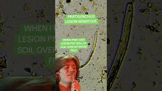 PRATYLENCHUS FOREVER nematodes science microscope biology [upl. by Leuas828]