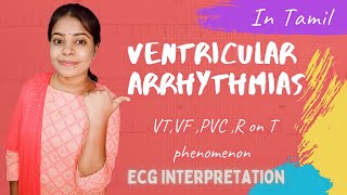 Ventricular Arrhythmias  ECG Interpretation in Tamil  VT VF PVC R on T Phenomenon [upl. by Solim]