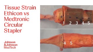 Comparison of Bunching During Device Closing  JampJ MedTech [upl. by Imrots]