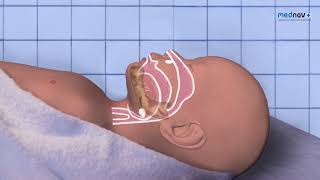 How to perform Neonatal Resuscitation Resuscitate Newborn NLS Newborn Life Support 2015 guidance [upl. by Loginov]