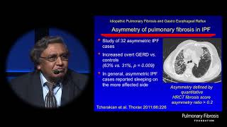 Gastroesophageal Reflux Disease GERD in ILD  Ganesh Raghu MD [upl. by Yarezed]