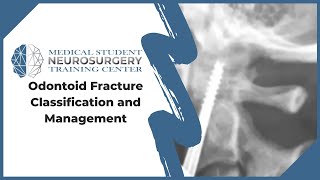 Odontoid Fracture Classification and Management [upl. by Aicener]