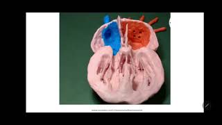 Development of Heart  Interventricular septum Bulbar septum and Aorticopulmonary septum [upl. by Staci722]