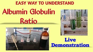 Albumin globulin ratio  Total protein estimation  Biuret method  Albumin estimation  BCG method [upl. by Eidaj]