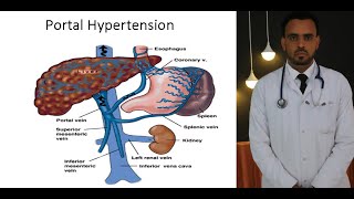 Management of Portal Hypertension and Variceal bleeding [upl. by Dygert261]