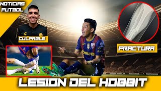 TERRIBLE entrada sobre el Hobbit Bermúdez del Atlante en Liga de Expansión [upl. by Eliak]