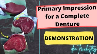 Primary Impression for a Complete Denture  Demonstration Super Simple [upl. by Derina539]