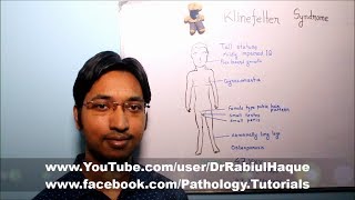 Klinefelter Syndrome  Part 1 HD [upl. by Sletten899]