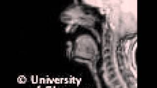 MRI voiced alveolar lateralapproximant [upl. by Lorenza]