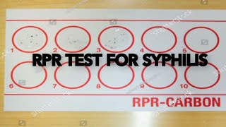 RPR Rapid Plasma Reagin test [upl. by Alvera]