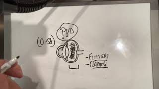 Posterior Vitreous Detachment  PVD Patient Educational Video [upl. by Stout]