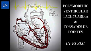 Polymorphic Ventricular Tachycardia Animation and ECG Shorts [upl. by Allehs]