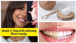 Teeth Whitening Simple amp Easy Home Remedy  Instant Result  Teeth Stain [upl. by Niwdla]