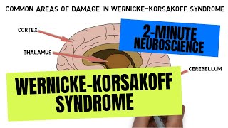 2Minute Neuroscience WernickeKorsakoff Syndrome [upl. by Yesnikcm391]