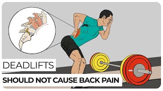 The Cause of Lower Back Pain After Deadlifts [upl. by Dlanor198]