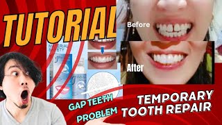 Tutorial How to use Moldable False teeth [upl. by Sugden]