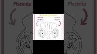 Why Your Placenta Location Matters [upl. by Aret]