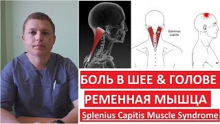 Ременная мышца  Как лечить боль в шее и голове  Splenius Capitis Muscle Syndrome [upl. by Venita207]