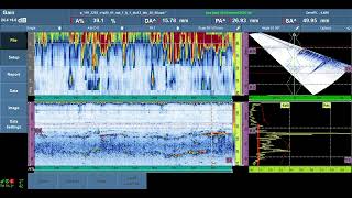 PAUT Phased array Ultrasonic Testing Data Interpretation [upl. by Hoagland]