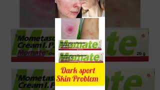 Momate cream mometasone furoate cream Short shortsfeed shortvideo ytshorts medicine [upl. by Ajam266]