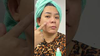 For Acne Prone and Sensitive Skin  AXIS  Y blemish spot Treatment [upl. by Odette]