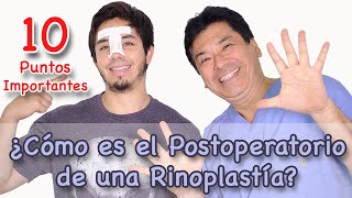 ¿Cómo es el Postoperatorio de una Rinoplastía [upl. by Tabbi722]